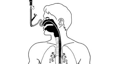 Immunonutrition Therapy